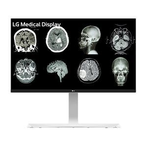 medizinisch Monitor