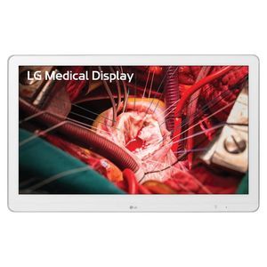 Diagnose-Monitor