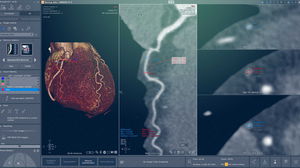 Software-Modul / Kardiologie