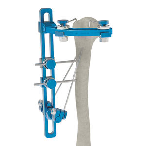 modularer Fixateur externe 1
