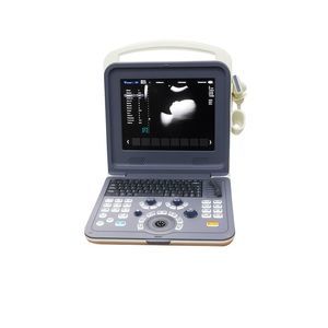tragbares Ultraschallgerät