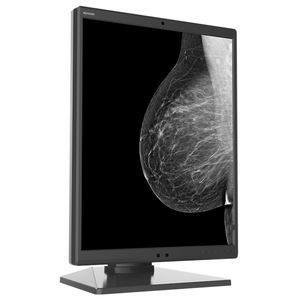 Mammographie-Monitor