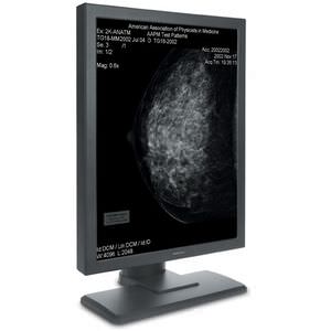 Mammographie-Monitor / für Radiologie / LCD / mit LED-Rückbeleuchtung