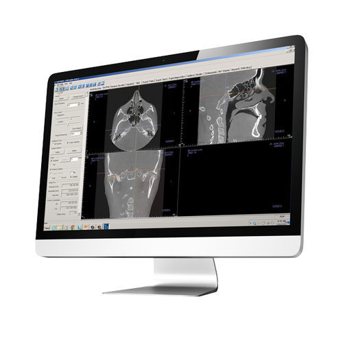 Behandlungsplanungssoftware - Tx STUDIO™ - DEXIS - CAD / 3D-Druck / Modellierung
