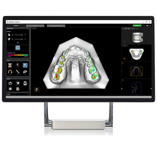 Software-Modul / Modellierung - CS Model - DEXIS - orthodontisch / Analyse / Behandlungsplanung