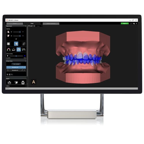 Software-Modul / Modellierung - CS Model+ - DEXIS - Analyse / Behandlungsplanung / orthodontisch