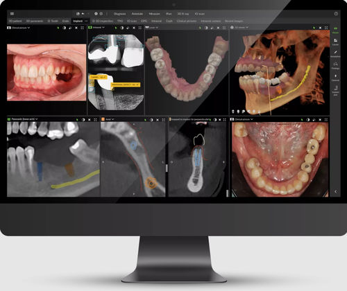 Software für Kliniken - DTX™ Studio - DEXIS - Dental / für dentale Bildgebung / Management