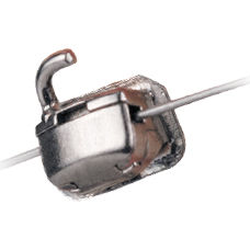 Backenzahn Vestibularröhrchen - SnapLink™ - Ormco - verstellbar