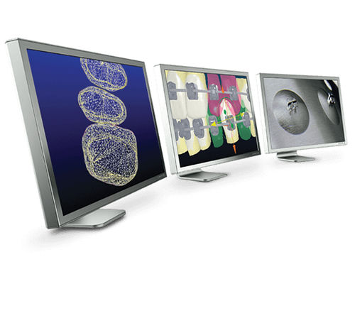 Software für Kieferorthopädie - Insignia™ - Ormco - Behandlungsplanung / für digitales Lächelndesign