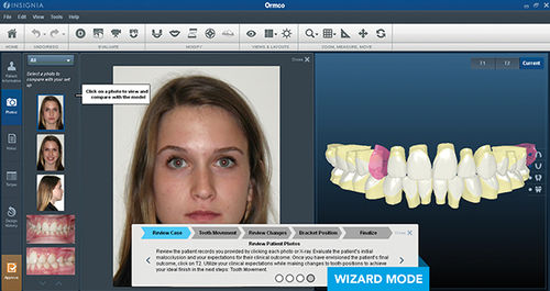 Software für digitales Lächelndesign - Insignia™ Ai - Ormco - für Kieferorthopädie