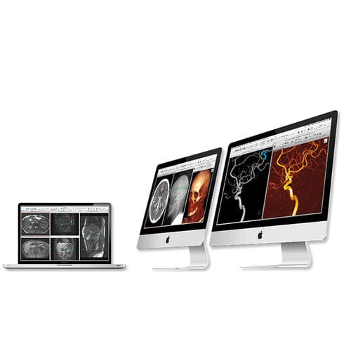 Nachbearbeitungssoftware - aycan Medical Systems - 3D-Visualisierung / Diagnose / Bewertung