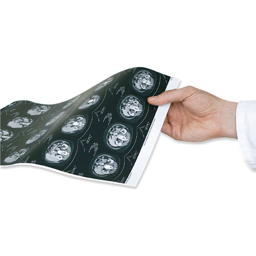 Behandlungsplanungssoftware - aycan Medical Systems - Content-Sharing / Druck / medizinisch