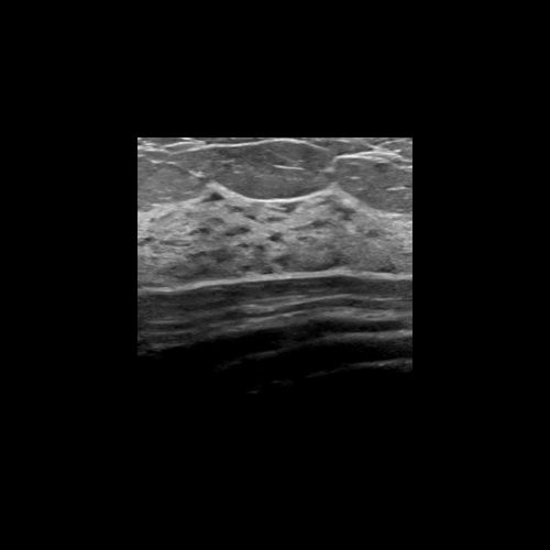 Software zur Bildverbesserung - Rivent™  - ContextVision - für Kliniken / für Ultraschalluntersuchungen / für kardiovaskuläre Chirurgie
