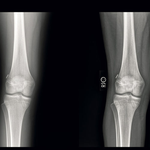 Röntgensoftware - ContextVision - für orthopädische Bildgebung / Orthopädie / Visualisierung