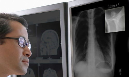 Diagnose-Software - CFS™ - Double Black Imaging - Monitoring / Kalibrierung / für medizinische Bildschirme