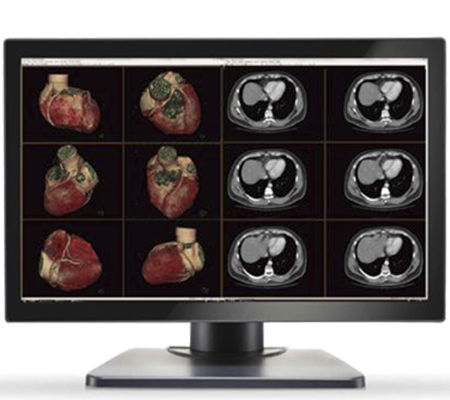 Medizinisch Monitor - GEMINI-6MP - Double Black Imaging - Diagnose / 30,4" / LCD