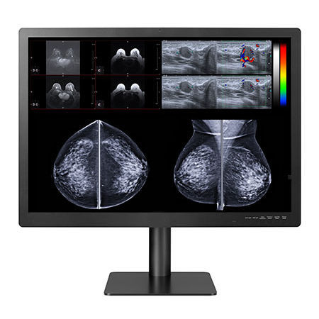 Medizinisch Monitor - GEMINI-12MP - Double Black Imaging - Diagnose / 31" / LCD
