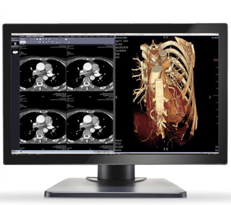 30"-Monitor - GEMINI-4MP - Double Black Imaging - LED / DVI / DisplayPort