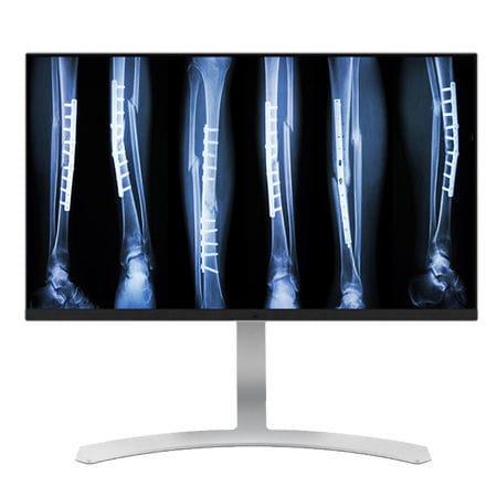 Medizinisch Monitor - CL8MPS - Double Black Imaging - Diagnose / 3840 × 2160 / 27"