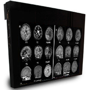 Medizinisch Monitor - DBI32 - Double Black Imaging - 1920x1200 / 32" / LED