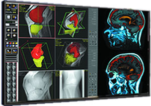 Medizinisch Monitor - DBI-PN47 - Double Black Imaging - 1920 x 1080 / LCD / HDMI