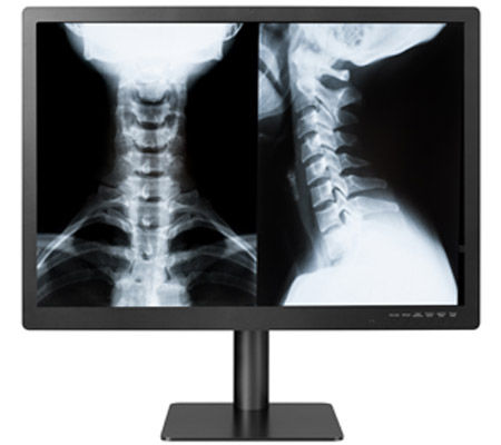 Medizinisch Monitor - GEMINI-8MP - Double Black Imaging - Diagnose / 3840 × 2160 / 31,5"