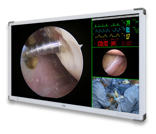 Medizinisch Monitor - C55SF - Double Black Imaging - OP / Full HD / 3840 × 2160