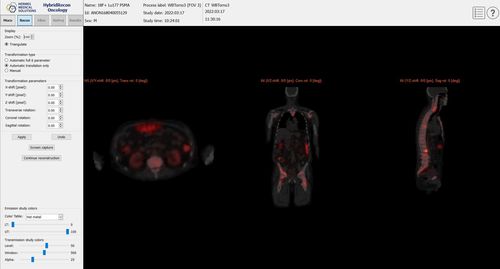 Software zur Qualitätskontrolle - SUV SPECT® - Hermes Medical Solutions, Inc - Beschaffung / Bestätigung / für Kliniken