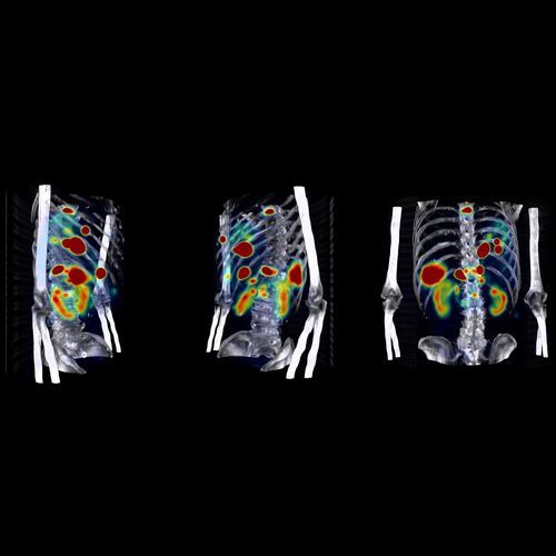 Diagnose-Software - Theranostics - Hermes Medical Solutions, Inc - Umform / medizinisch