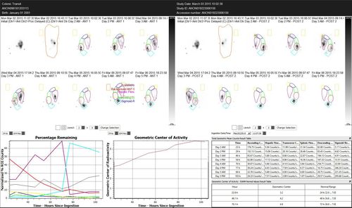 Analysesoftware - Hermes Medical Solutions, Inc - für Gastroenterologie