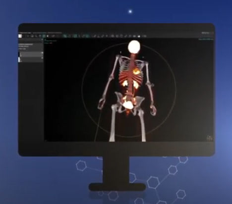Reporting-Software - vendor-neutral - Hermes Medical Solutions, Inc - für Kliniken / Computertomographie / TEP
