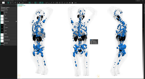 Umform-Software - Voxel dosimetry™ - Hermes Medical Solutions, Inc - Bestätigung / für Kliniken / Computertomographie