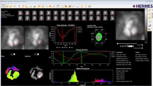 Analysesoftware - Hermes Medical Solutions, Inc - Reporting / Diagnose / Beschaffung