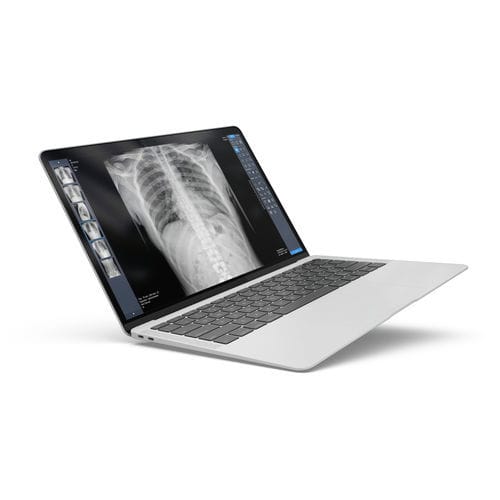 Röntgensoftware - ExamVue Duo - JPI Healthcare Solutions - Analyse / Management / Diagnose