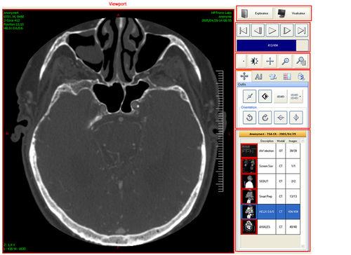Visualisierungssoftware - Ultima Digital Illuminator - Medsquare - Datenaustausch / für DCIM-Datei / für OP-Saal