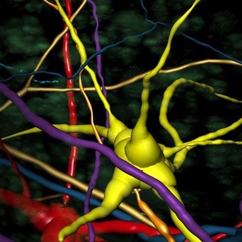 Analysesoftware - Imaris  - Oxford Instruments - 3D-Visualisierung / Mess / überwacht