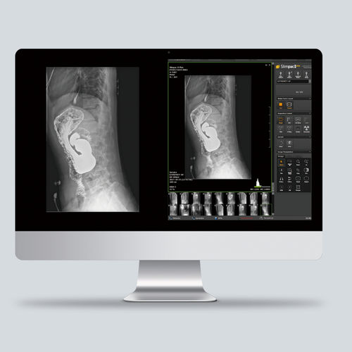 Röntgensoftware - Slimpac Ⅱ Plus - Vieworks - Steuerung / Viewer / Diagnose
