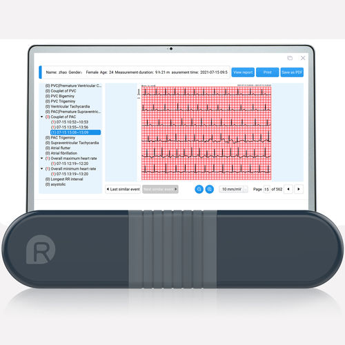 Langzeit-EKG / 1 Kanal - HeartView - Shenzhen Viatom Technology Co., Ltd.