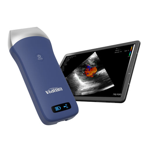Ultraschall-Handgerät - Shenzhen Viatom Technology Co., Ltd. - für Multifunktions-Ultraschall / für Lungen-Ultraschall / Schwarz-Weiß