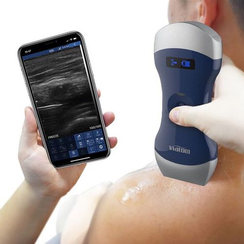 Ultraschall-Handgerät - Uprobe-C 4PL - Shenzhen Viatom Technology Co., Ltd. - für Multifunktions-Ultraschall / Schwarz-Weiß / Farbdoppler