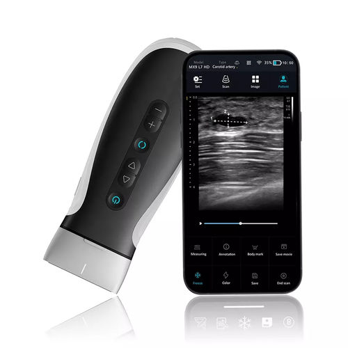 Ultraschall-Handgerät - MX9V - Shenzhen Viatom Technology Co., Ltd. - für Multifunktions-Ultraschall / Schwarz-Weiß / Farbdoppler