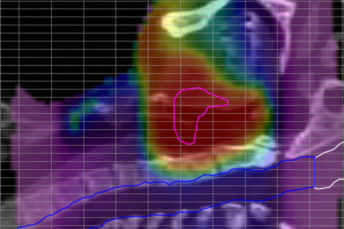 Medizinische Software - ScandiDos - für Kliniken / Anatomie / Analyse