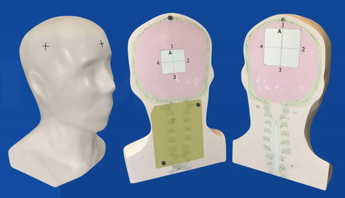 Testphantom für Strahlentherapie - Lucy-HD - Standard Imaging - Kopf / Gehirn / Schädel