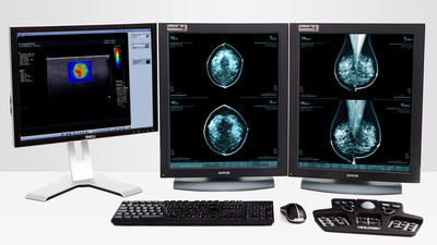 Analysesoftware - MeVis Medical Solutions AG - Diagnose / Planung / CAD