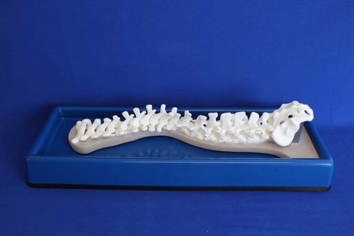 Anatomisches Modell / Wirbelsäule - SDEP - Créaplast - für Skoliose