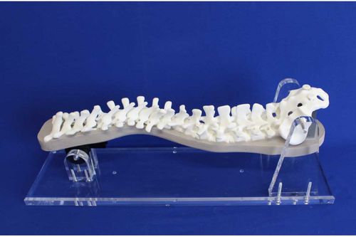 Anatomisches Modell / Wirbelsäule - S3DEP - Créaplast - für die Ausbildung / für Skoliose