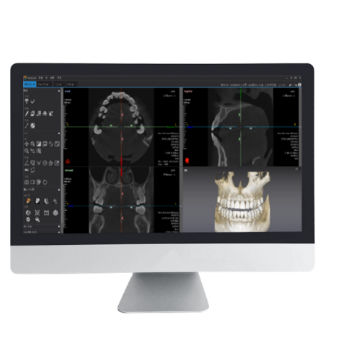 Analysesoftware - Dentiq 3D - 3D Industrial Imaging, Co., Ltd. - 3D-Visualisierung / Diagnose / Behandlungsplanung