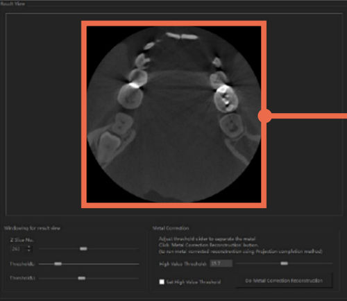 Bildanalyse-Software - DentiqRecon - 3D Industrial Imaging, Co., Ltd. - medizinisch / Computertomographie