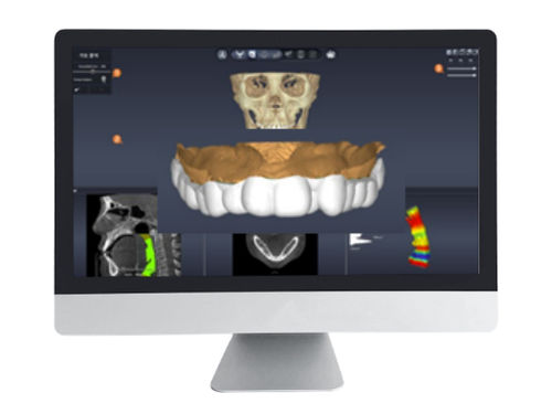 Projektentwicklungssoftware - DentiqAir - 3D Industrial Imaging, Co., Ltd. - medizinisch / Dental