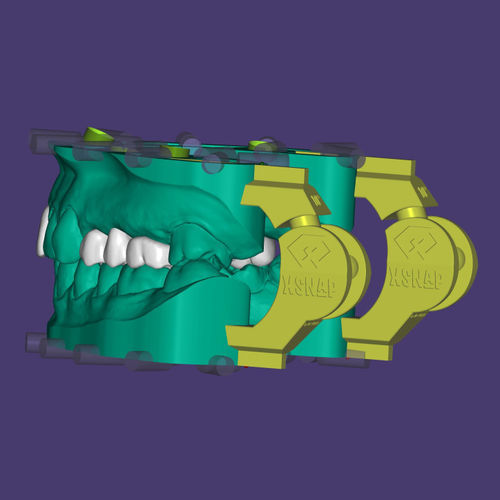 Software-Modul / für Dentalimplantologie - xSNAP® - Champions Implants GmbH - Modellierung